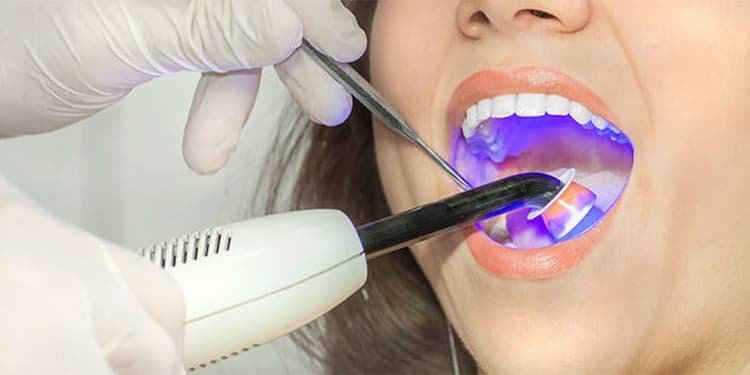 دندانپزشکی با لیزر در کرج