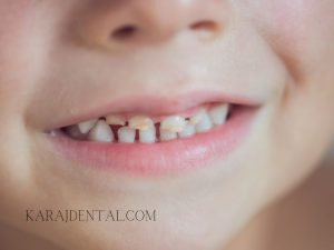 بهترین کلینیک دندانپزشکی کودکان در کرج