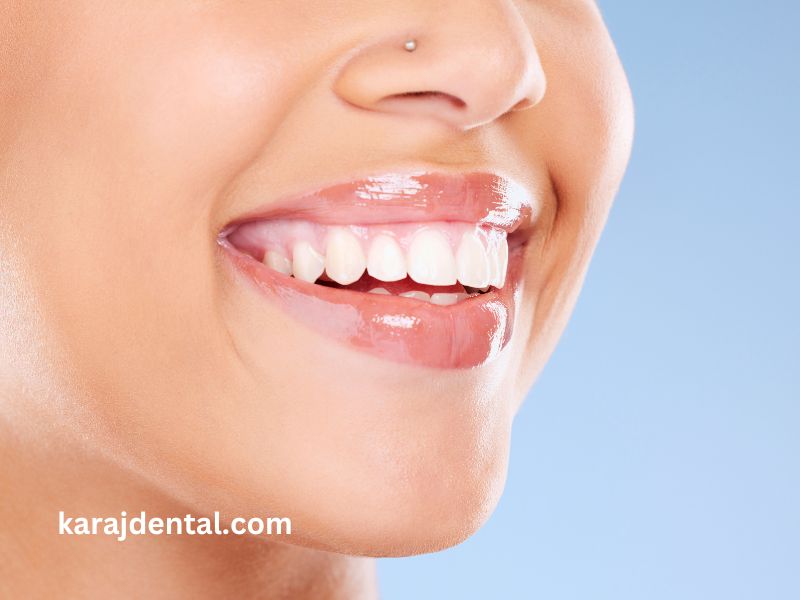 دندانپزشکی طرف قرارداد با بیمه تجارت نو در کرج