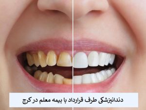 دندانپزشکی طرف قرارداد با بیمه معلم در کرج