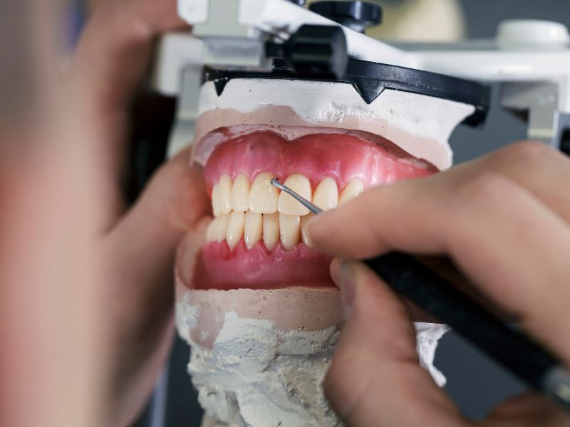 لیست قیمت دندان مصنوعی ژله ای در کرج