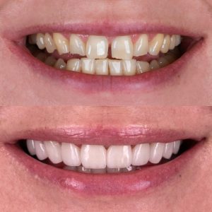 دندانپزشک متخصص ترمیمی و زیبایی در کرج